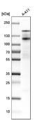 Desmoglein 2 antibody, NBP1-85709, Novus Biologicals, Western Blot image 