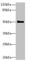 Interferon-induced protein 44 antibody, A62762-100, Epigentek, Western Blot image 