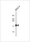 Ubiquitin Conjugating Enzyme E2 L6 antibody, 61-081, ProSci, Western Blot image 