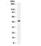 Phosphatase And Tensin Homolog antibody, R32154, NSJ Bioreagents, Western Blot image 