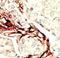 Serine/Threonine Kinase 11 antibody, LS-C100773, Lifespan Biosciences, Immunohistochemistry paraffin image 