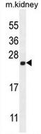 Calmodulin Like 4 antibody, AP50715PU-N, Origene, Western Blot image 