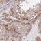 Larp antibody, NBP2-49004, Novus Biologicals, Immunohistochemistry paraffin image 