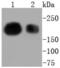 SWI/SNF Related, Matrix Associated, Actin Dependent Regulator Of Chromatin, Subfamily A, Member 4 antibody, NBP2-67720, Novus Biologicals, Western Blot image 