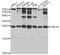 Ubiquitin Conjugating Enzyme E2 K antibody, STJ26019, St John