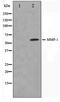 Matrix Metallopeptidase 1 antibody, TA347429, Origene, Western Blot image 