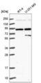 Semaphorin 3A antibody, NBP2-56804, Novus Biologicals, Western Blot image 