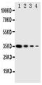 Eukaryotic Translation Initiation Factor 2 Alpha Kinase 2 antibody, PA2025, Boster Biological Technology, Western Blot image 