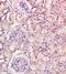 Fibroblast Growth Factor 7 antibody, GTX37698, GeneTex, Immunohistochemistry paraffin image 