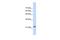 RAS Like Family 10 Member A antibody, PA5-43780, Invitrogen Antibodies, Western Blot image 