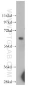 Arylsulfatase D antibody, 11805-1-AP, Proteintech Group, Western Blot image 