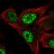 RCAN Family Member 3 antibody, NBP2-57619, Novus Biologicals, Immunofluorescence image 