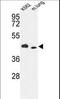 Inositol-Trisphosphate 3-Kinase A antibody, LS-C100942, Lifespan Biosciences, Western Blot image 