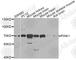 Serine/threonine-protein kinase PINK1, mitochondrial antibody, A7131, ABclonal Technology, Western Blot image 