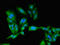 Protein Kinase CAMP-Activated Catalytic Subunit Beta antibody, LS-C679164, Lifespan Biosciences, Immunofluorescence image 