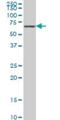 Serine/Threonine Kinase 33 antibody, H00065975-M09, Novus Biologicals, Western Blot image 