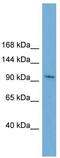 Serine/Threonine Kinase 31 antibody, TA339776, Origene, Western Blot image 
