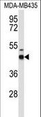 Gamma-Aminobutyric Acid Type A Receptor Delta Subunit antibody, LS-C166328, Lifespan Biosciences, Western Blot image 