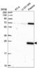 C-Type Lectin Domain Containing 7A antibody, NBP2-55630, Novus Biologicals, Western Blot image 