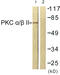 Protein Kinase C Alpha antibody, LS-C117772, Lifespan Biosciences, Western Blot image 