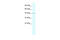 RuvB Like AAA ATPase 2 antibody, 27-571, ProSci, Western Blot image 