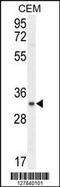 Chromosome 11 Open Reading Frame 74 antibody, 55-269, ProSci, Western Blot image 