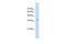 RALY Heterogeneous Nuclear Ribonucleoprotein antibody, GTX47776, GeneTex, Western Blot image 