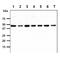 Proteasome 26S Subunit, Non-ATPase 11 antibody, GTX57692, GeneTex, Western Blot image 
