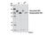 ADAM Metallopeptidase Domain 17 antibody, 6978T, Cell Signaling Technology, Western Blot image 