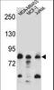 AFG3 Like Matrix AAA Peptidase Subunit 2 antibody, LS-C156132, Lifespan Biosciences, Western Blot image 