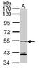 Interferon Regulatory Factor 5 antibody, GTX104852, GeneTex, Western Blot image 