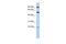 Nuclear Receptor Subfamily 1 Group D Member 2 antibody, A04958, Boster Biological Technology, Western Blot image 