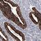 YTH Domain Containing 2 antibody, NBP1-85089, Novus Biologicals, Immunohistochemistry frozen image 