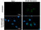 Microtubule Associated Protein 1 Light Chain 3 Beta antibody, GTX632501, GeneTex, Immunofluorescence image 