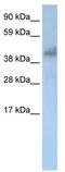 Zinc Finger Protein 620 antibody, TA329440, Origene, Western Blot image 