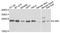 Interleukin-36 alpha antibody, LS-B15520, Lifespan Biosciences, Western Blot image 
