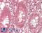 Frizzled Class Receptor 6 antibody, LS-B13443, Lifespan Biosciences, Immunohistochemistry paraffin image 