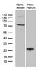 Tumor necrosis factor receptor superfamily member 18 antibody, M03125, Boster Biological Technology, Western Blot image 