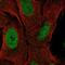 Zinc Finger Protein 296 antibody, NBP2-56682, Novus Biologicals, Immunofluorescence image 
