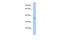 Carcinoembryonic Antigen Related Cell Adhesion Molecule 19 antibody, A15268, Boster Biological Technology, Western Blot image 