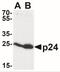 HIV-1 gp24 antibody, NBP2-41214, Novus Biologicals, Western Blot image 