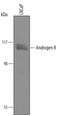 Androgen Receptor antibody, AF5876, R&D Systems, Western Blot image 