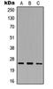 Macrophage Scavenger Receptor 1 antibody, orb304605, Biorbyt, Western Blot image 