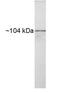 Heat shock protein 104 antibody, GTX79161, GeneTex, Western Blot image 