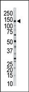 Myosin Light Chain Kinase antibody, AP14867PU-N, Origene, Western Blot image 