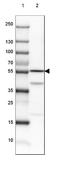 Dihydrolipoamide Dehydrogenase antibody, NBP2-13926, Novus Biologicals, Western Blot image 