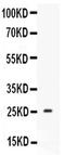 Prolactin antibody, PA5-79875, Invitrogen Antibodies, Western Blot image 