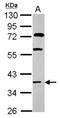 Homeobox C13 antibody, NBP2-14987, Novus Biologicals, Western Blot image 