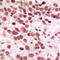 CTD Small Phosphatase 1 antibody, LS-C353519, Lifespan Biosciences, Immunohistochemistry paraffin image 