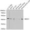 Gamma-Butyrobetaine Hydroxylase 1 antibody, GTX30083, GeneTex, Western Blot image 